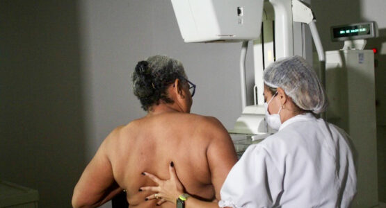 Prefeitura de Macapá promove mutirão de mamografia para mulheres do distrito do Maruanum 