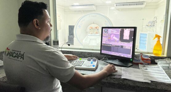 Em 1 ano, tomografia do Centro de Especialidades Municipal já registra mais de 17 mil atendimentos em Macapá